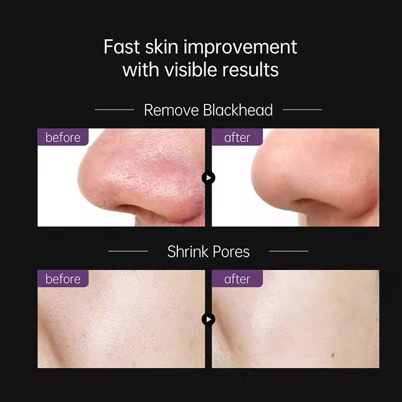 Aiooce Zero Pore Blackhead Peel-Off Mask – Deep Cleanse & Refine Pores