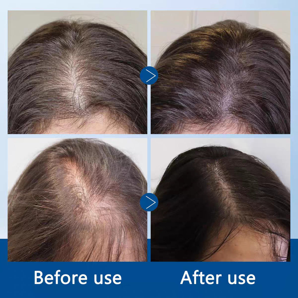 Hair Growth Serum Roll-On | Scalp Cooling Hair Ampoule for Strong, Healthy Hair