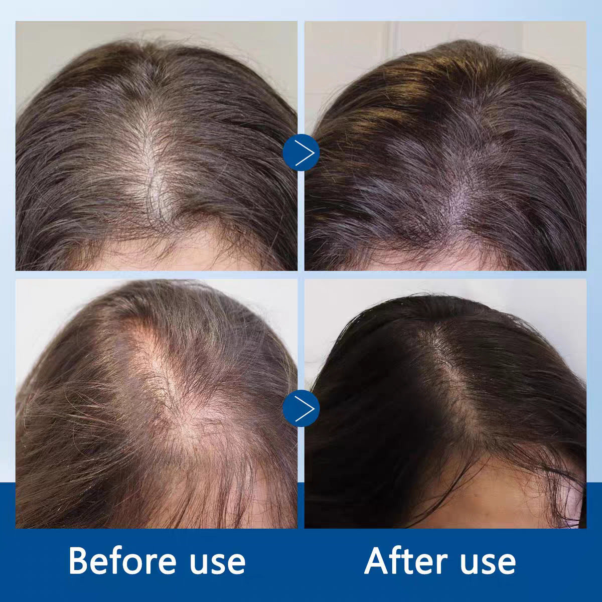Hair Growth Serum Roll-On | Scalp Cooling Hair Ampoule for Strong, Healthy Hair