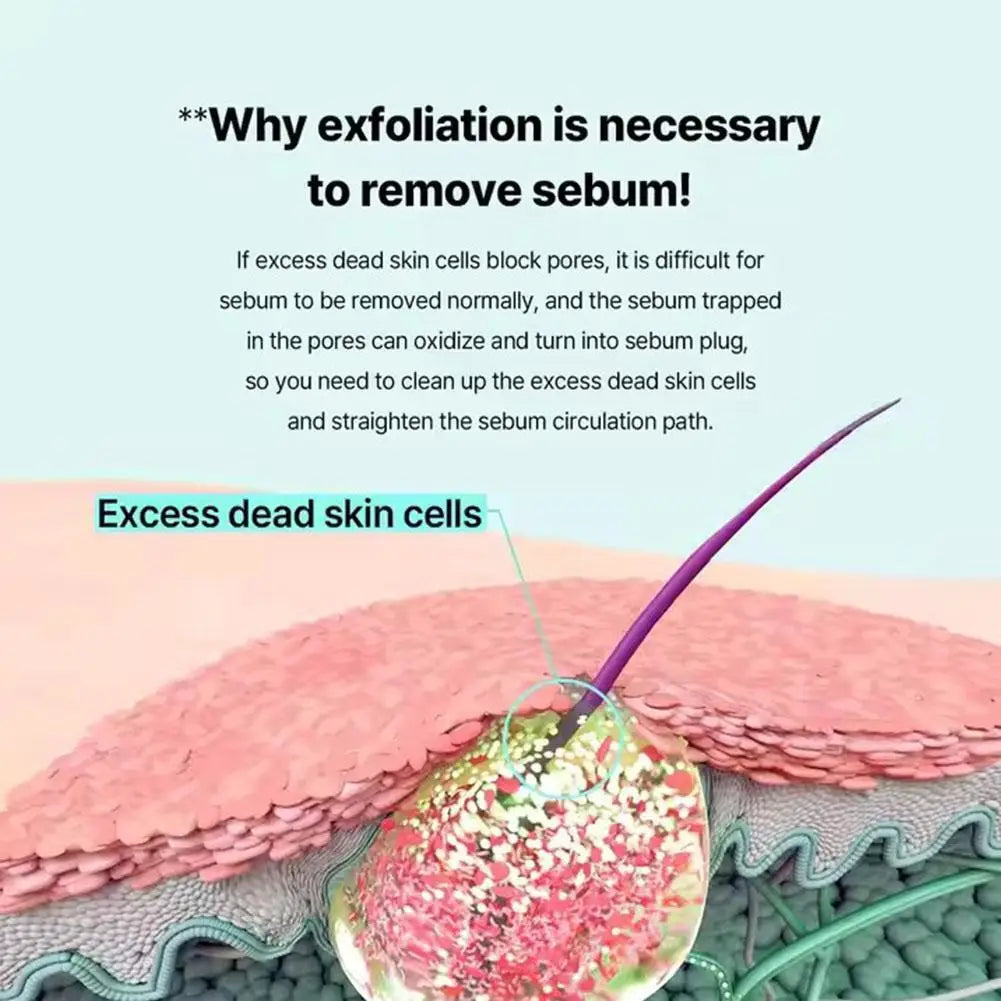 Blackhead Remover Liquid, Gentle Sebum Softener for Pore Cleansing